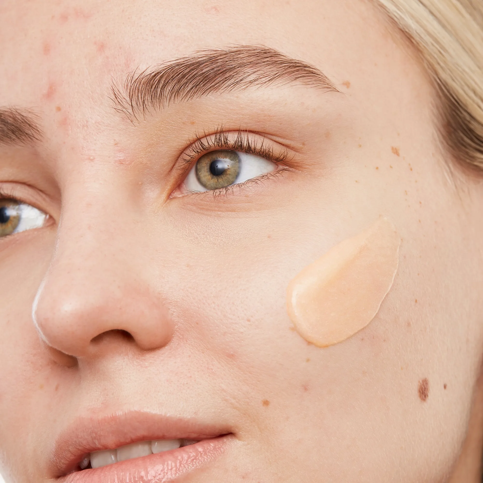 Acne Gel Cleanser