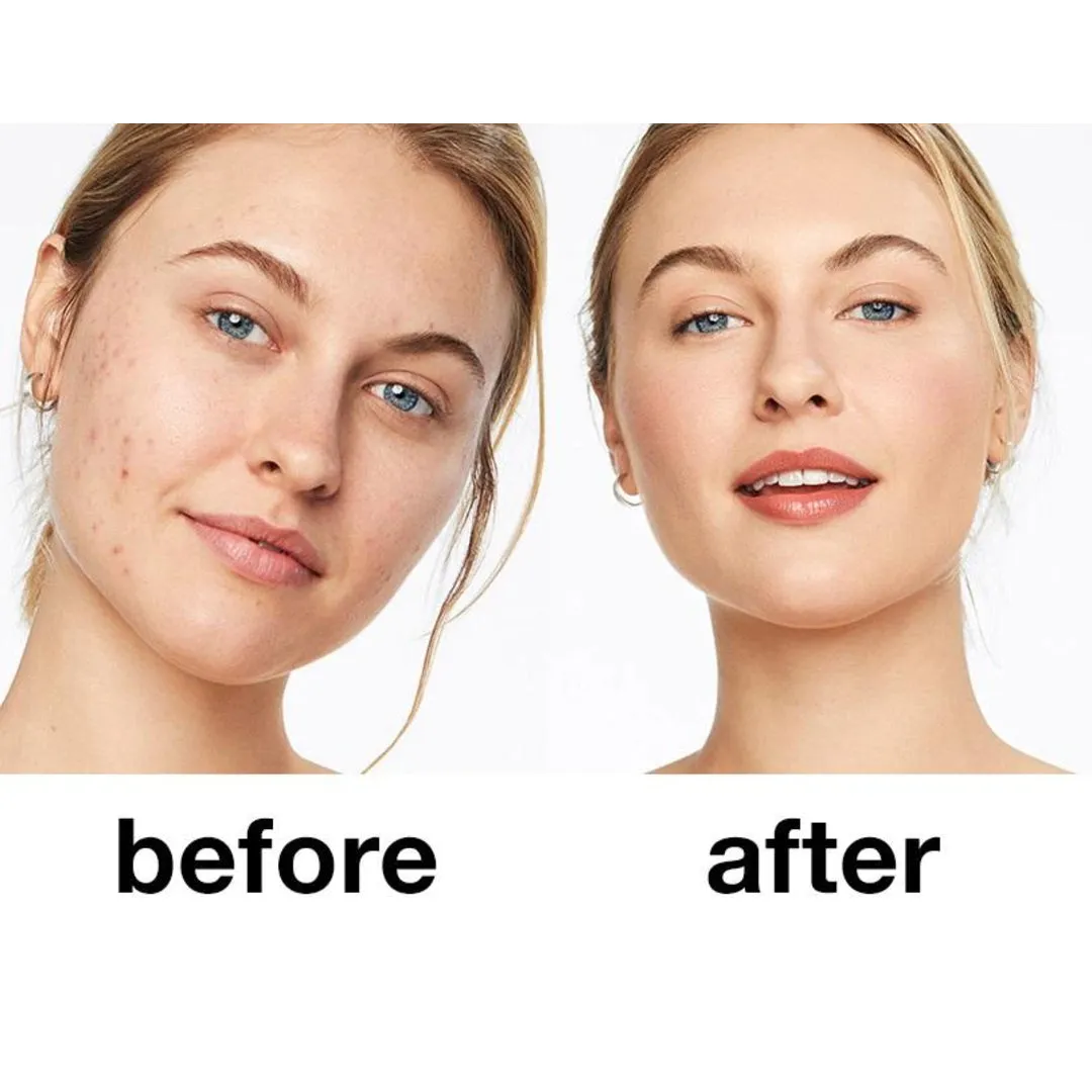 Clinique Anti-Blemish Solutions Liquid Foundation 30 ml