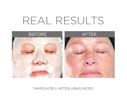 Cosmedix Micro Defense Sheet Mask