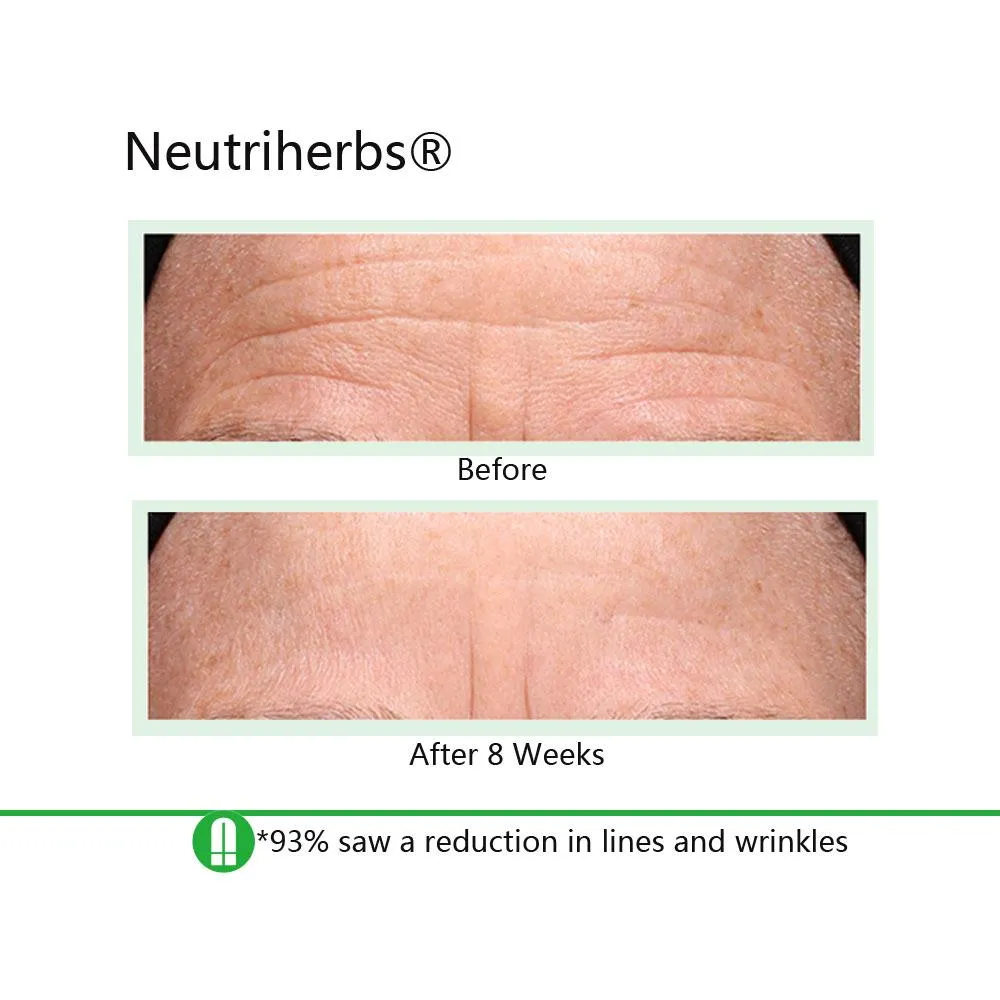 Neutriherbs® Best Duo For Aging & Acne-prone Skin